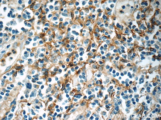 [23750-1-AP-150UL] ENOX1 Polyclonal antibody