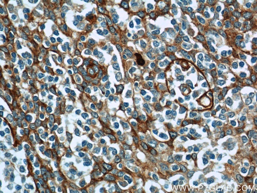 [23778-1-AP-20UL] ADAM8 Polyclonal antibody