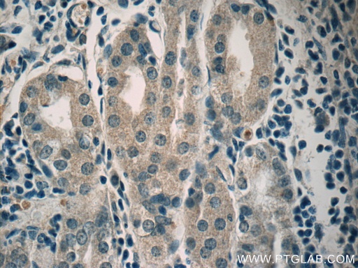 [23781-1-AP-150UL] ADM2 Polyclonal antibody