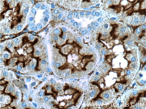 [23782-1-AP-20UL] MME,CD10 Polyclonal antibody