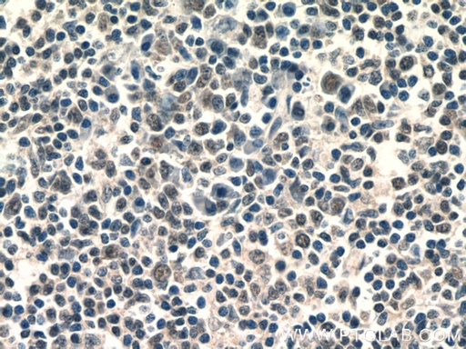 [23785-1-AP-20UL] AKNA Polyclonal antibody
