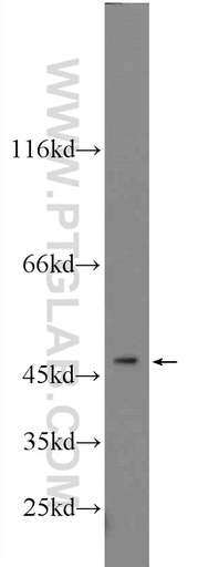 [23799-1-AP-150UL] ZNF271 Polyclonal antibody