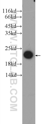 [23809-1-AP-20UL] FATE1 Polyclonal antibody