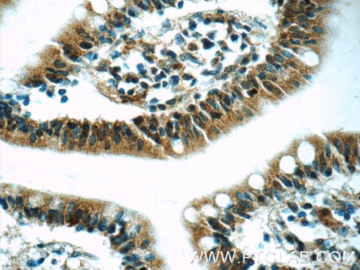 [23826-1-AP-20UL] RSRC1 Polyclonal antibody