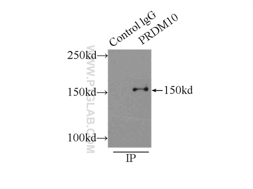 [23827-1-AP-20UL] PRDM10 Polyclonal antibody