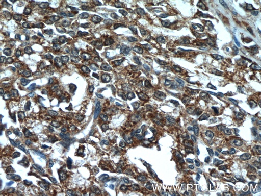 [23838-1-AP-20UL] ANXA2R Polyclonal antibody