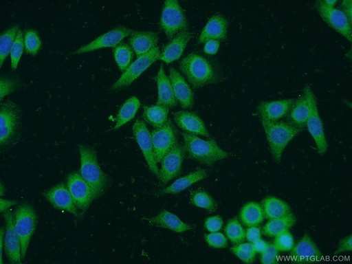 [23854-1-AP-20UL] BCHE Polyclonal antibody