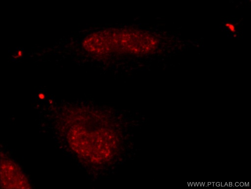 [23865-1-AP-20UL] USP39 Polyclonal antibody