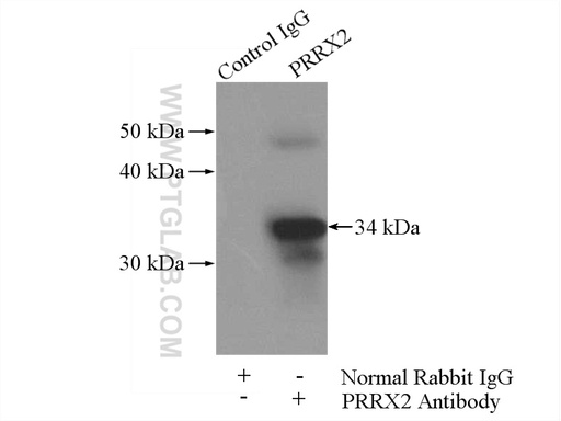 [23869-1-AP-150UL] PRRX2 Polyclonal antibody