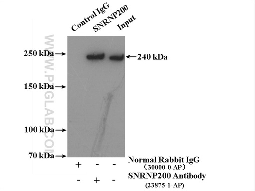 [23875-1-AP-20UL] SNRNP200 Polyclonal antibody