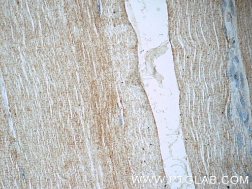 [23880-1-AP-20UL] MYOZ3 Polyclonal antibody