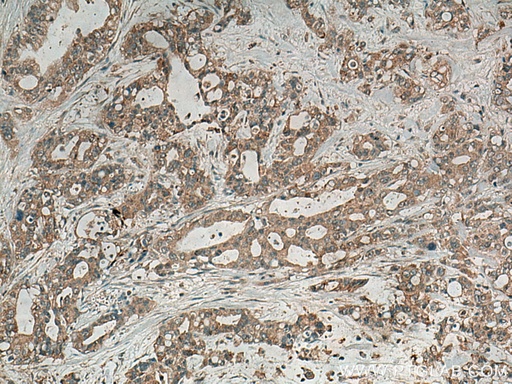 [23881-1-AP-20UL] Alpha Internexin Polyclonal antibody