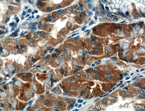 [23882-1-AP-150UL] TMEM208 Polyclonal antibody