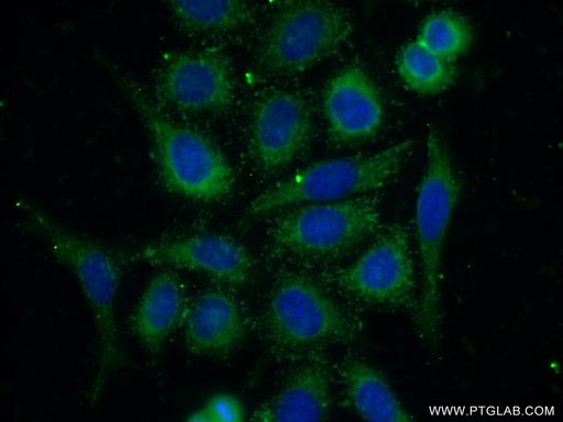 [23885-1-AP-20UL] PPP2R5E Polyclonal antibody