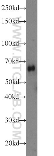 [23887-1-AP-150UL] ODF2L Polyclonal antibody