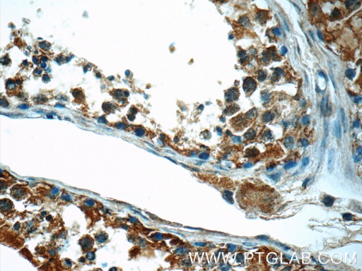 [23891-1-AP-150UL] CEP55 Polyclonal antibody