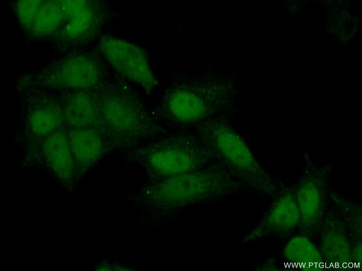 [23894-1-AP-20UL] ATAD2 Polyclonal antibody