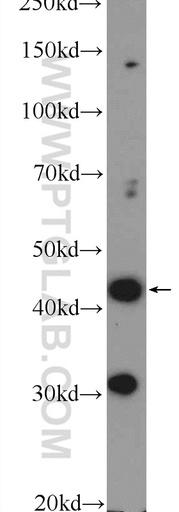 [23897-1-AP-20UL] BTBD8 Polyclonal antibody