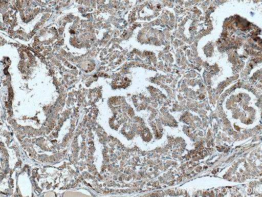 [23899-1-AP-150UL] TNFSF18 Polyclonal antibody