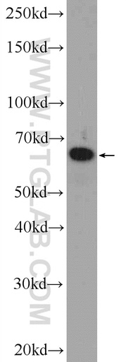 [23902-1-AP-20UL] RBM47 Polyclonal antibody
