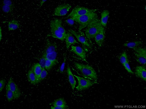 [23906-1-AP-150UL] MYO19 Polyclonal antibody