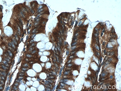 [23909-1-AP-150UL] AFAP1L1 Polyclonal antibody