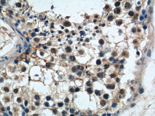[23929-1-AP-20UL] PRPF6 Polyclonal antibody