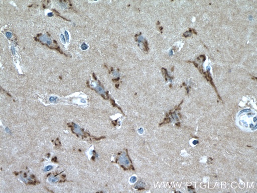 [23943-1-AP-20UL] FRMPD4 Polyclonal antibody