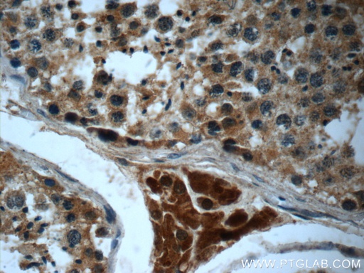 [23944-1-AP-20UL] HEATR4 Polyclonal antibody