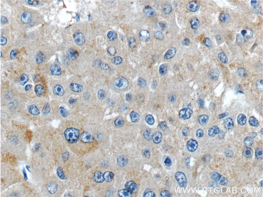 [23945-1-AP-20UL] IGHMBP2 Polyclonal antibody
