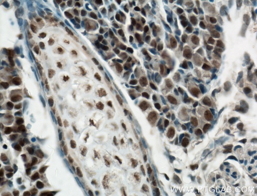 [23969-1-AP-150UL] RCOR2 Polyclonal antibody