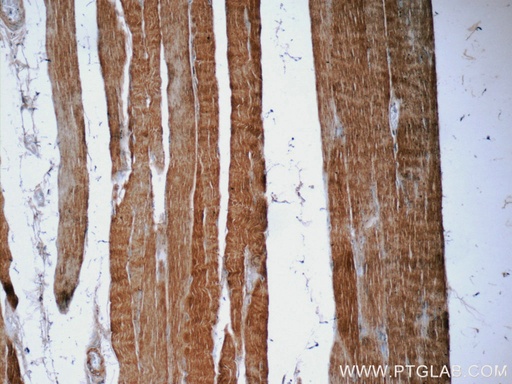 [23974-1-AP-20UL] EB3 Polyclonal antibody
