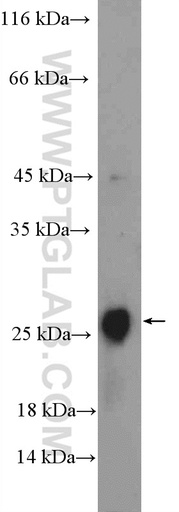 [23994-1-AP-150UL] CLRN2 Polyclonal antibody