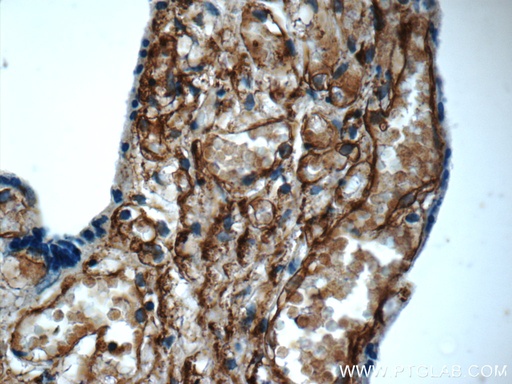 [23997-1-AP-20UL] AMPD3 Polyclonal antibody
