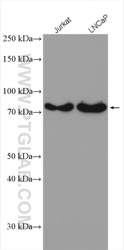 [23998-1-AP-20UL] ANKRD13A Polyclonal antibody