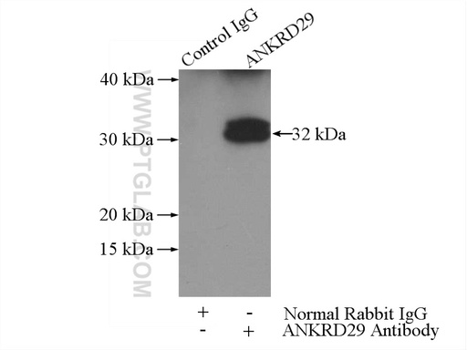 [23999-1-AP-150UL] ANKRD29 Polyclonal antibody