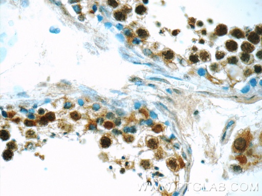 [24000-1-AP-20UL] ANKRD13C Polyclonal antibody
