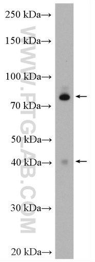 [24002-1-AP-150UL] CEP89 Polyclonal antibody