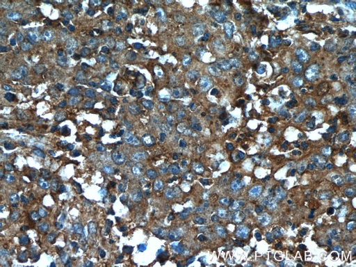 [24024-1-AP-20UL] B4GALNT2 Polyclonal antibody