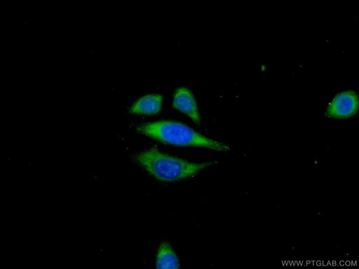 [24027-1-AP-20UL] ANKRD39 Polyclonal antibody