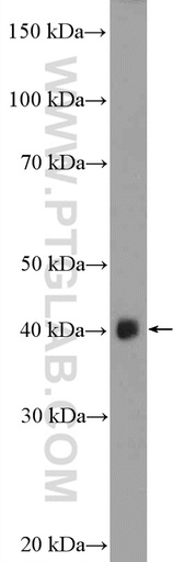 [24031-1-AP-150UL] ASB5 Polyclonal antibody