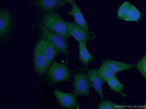 [24034-1-AP-150UL] ANKRD27 Polyclonal antibody