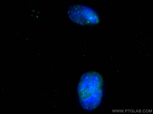 [24050-1-AP-20UL] Glucocorticoid receptor Polyclonal antibody