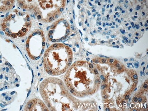 [24055-1-AP-150UL] HSN2 Polyclonal antibody