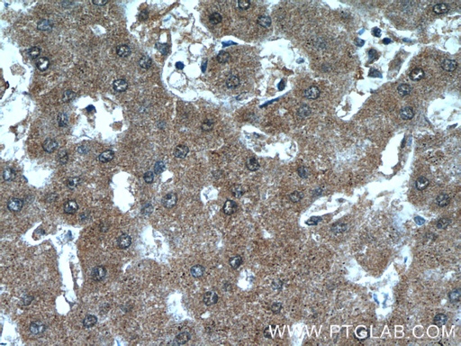 [24058-1-AP-150UL] ANKS3 Polyclonal antibody