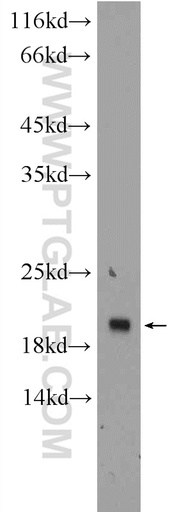 [24059-1-AP-20UL] TMEM27 Polyclonal antibody