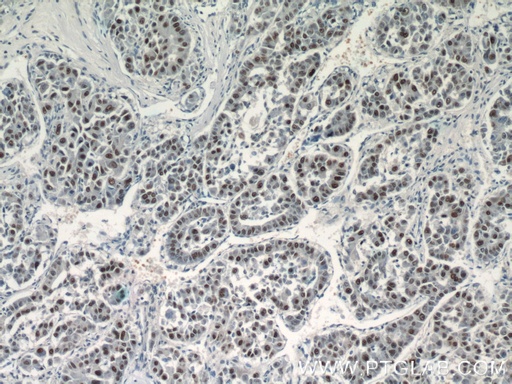 [24061-1-AP-150UL] SGF29 Polyclonal antibody