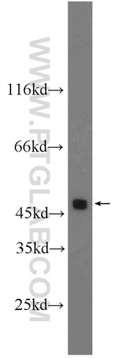 [24063-1-AP-20UL] DR4 Polyclonal antibody