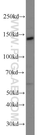 [24064-1-AP-150UL] Matrilin 2 Polyclonal antibody
