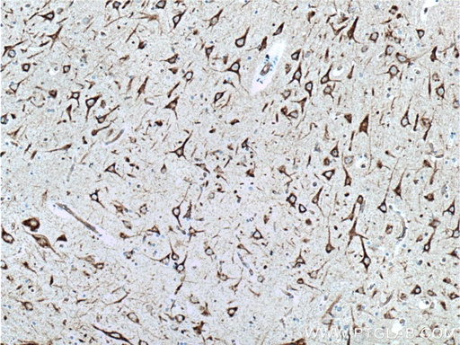 [24065-1-AP-20UL] NHEDC2 Polyclonal antibody